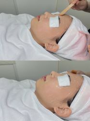 -慕颜医疗美容·皮肤微整 抗衰