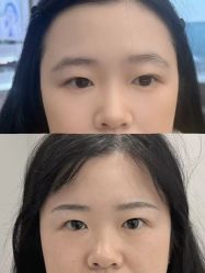 -张小野·专业半永久纹眉