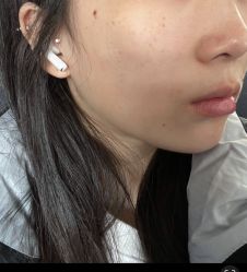 -More摩尔医美の注射线雕光电中心