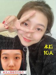 -北京米扬丽格医疗美容·联合丽格鼻整形中心