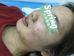点击看大图 -苗院长皮肤管理中心