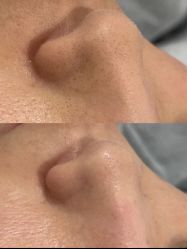 -SKIN79皮肤管理中心