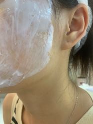 体验前-美莱医学美容医院