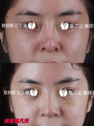 -北京米扬丽格医疗美容·联合丽格鼻整形中心