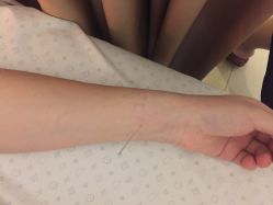 -肥三针腧穴瘦身馆