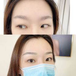 -MIVI半永久纹眉绣眉