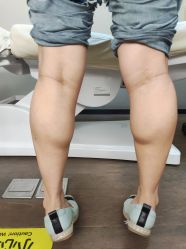 -四川米兰柏羽医学美容医院
