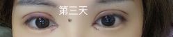 体验后-上海时光整形外科医院