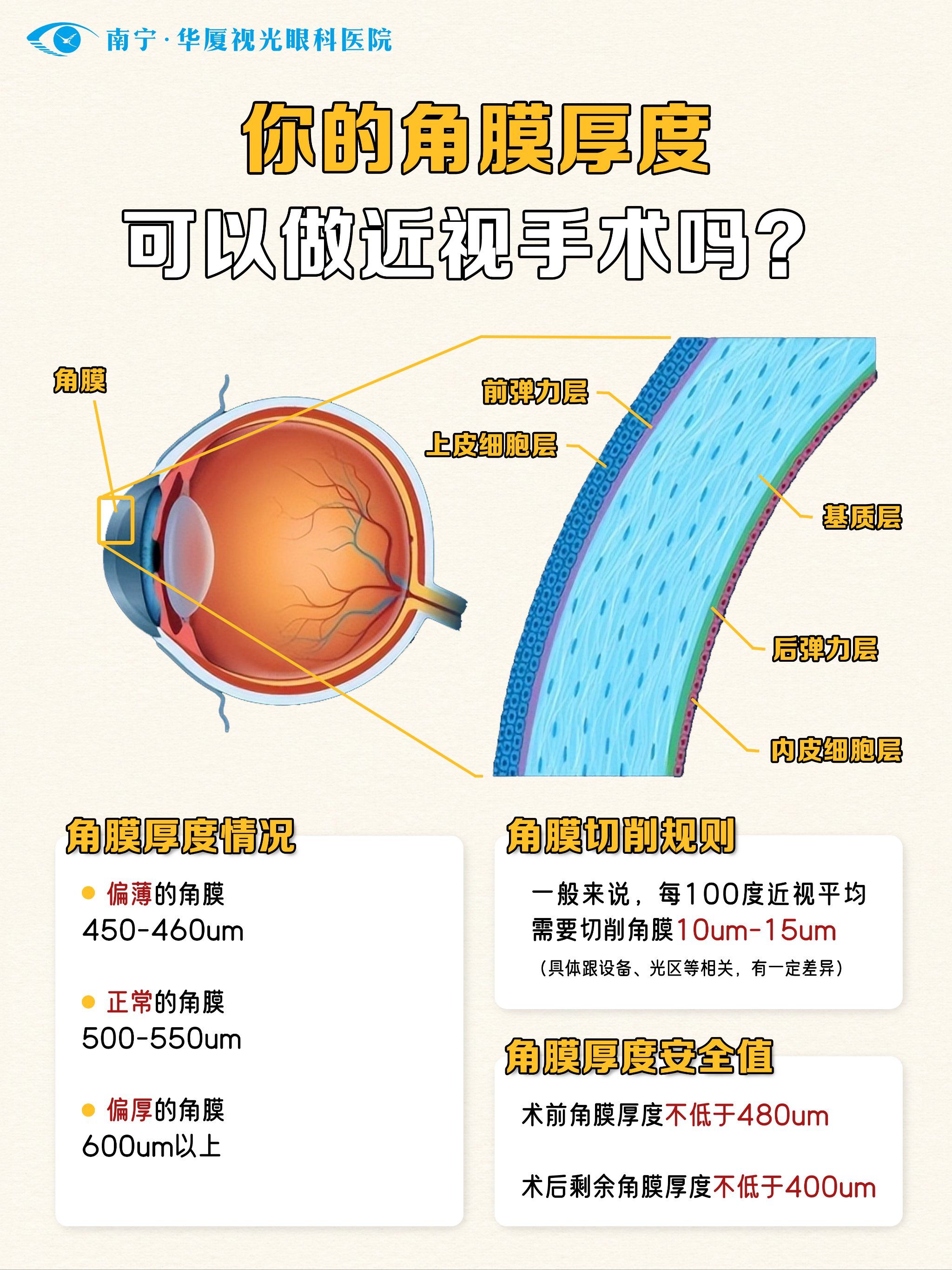 你的角膜厚度可以做近视手术吗?