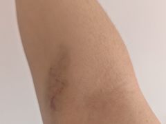 -天津市第一中心医院(复康路院区)