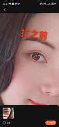 -深圳阳光医疗美容医院·旗舰店