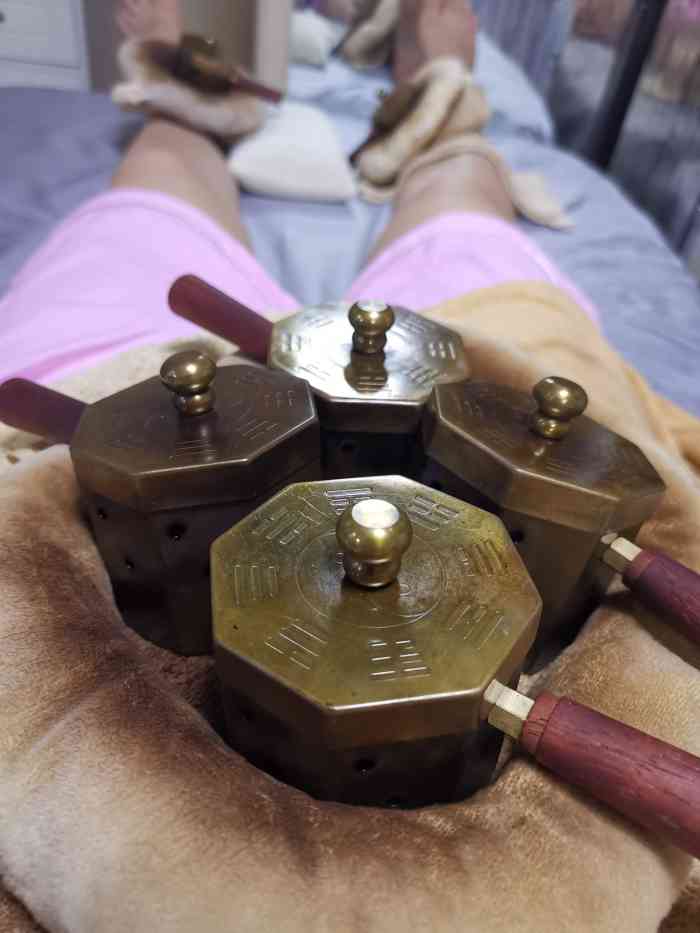 马氏温灸(凯德店)-"【项目】艾灸中了霸王餐艾灸暖宫,提前预.