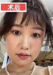 -素美医疗美容·西南眼鼻整形·修复基地