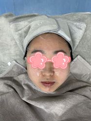 体验后-叶美人医疗美容