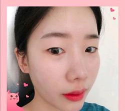 点击看大图 -南昌臻爱医疗美容