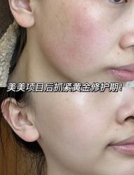 点击看大图 -半岛故事·法儿曼抗衰·indiba中心