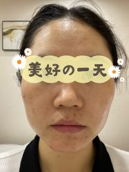 体验后-贞禾医美·连锁