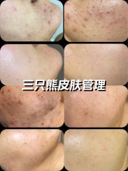 -三只熊皮肤管理中心旗舰店