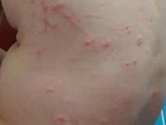 -中国医学科学院皮肤病医院