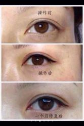 iphone_upload_pic-尚玲纹绣纹眉特价店