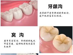 -团圆口腔·种植中心(锦江院区)