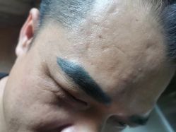 点击看大图 -西施无菌半永久纹绣眉眼影唇轻增发纹发际线