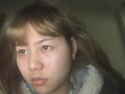 -安徽合肥韩美整形外科医院