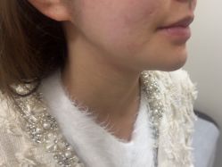 -Yestar艺星整形美容医院