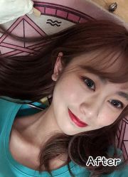 -小忠丽格医美