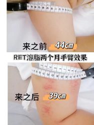 -Lily纤美·科技减脂中心