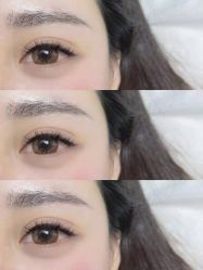 -U-Nail