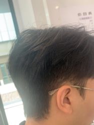 -天使之手