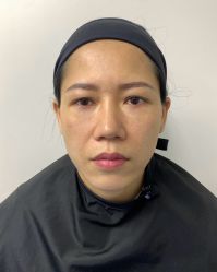 -广州健丽·去眼袋医疗美容机构