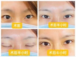 体验前-SKINIST丽铂医疗美容