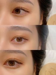 -宥莉·ULLY 痘敏肌•科技皮肤管理中心