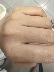 -嘉和医学脱毛中心