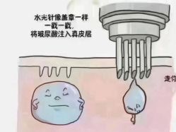 -+MS卓美丝专业祛痘·皮肤管理中心
