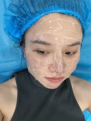 体验前-郑荃丽格医疗美容