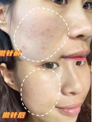 -八大处整形