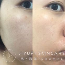 点击看大图 -MLP美丽派·问题肌疗愈中心