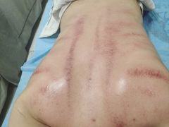 -张钰强中医正骨推拿连锁(唐家人才公寓店)