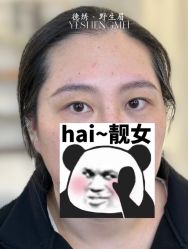 -德绣·机器野生眉发际线·美瞳线半永久
