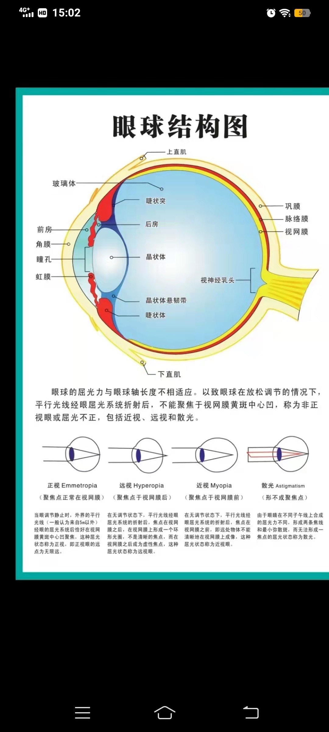 眼球的结构示意图简笔图片