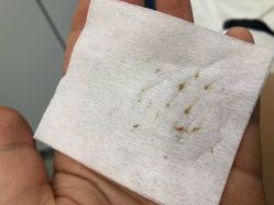 -痘瑞仕·专业祛痘国际连锁