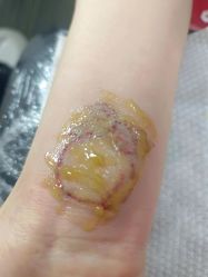 -净肤洗纹身
