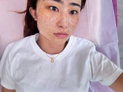 点击看大图 体验后-烟台曙光医疗美容医院