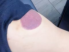 -想来盲人推拿(香溢花城店)