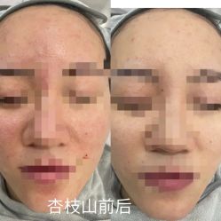 -skin79皮肤管理中心