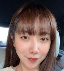 -碧莲盛·不剃发植发