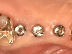 -精德口腔·种植修复·儿牙中心(财富中心店)